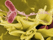 Invaze intracelulrn ijc bakterie dovnit buky, zdroj: fotobanka Pixabay 