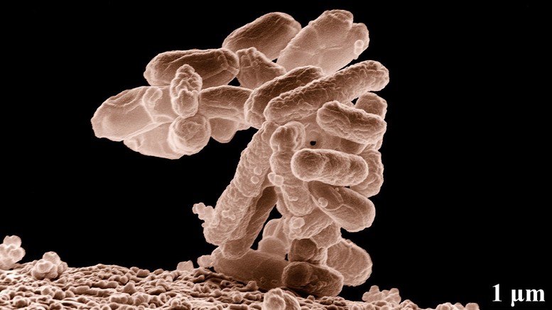 Výskyt koliformních bakterií ve vodě - mohou vznikat i rozkladem listí ve studni, Escherichia coli, foto Euroclean