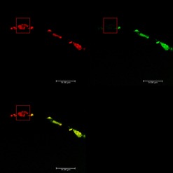 Obr. 4: Kolokalizace nanodiamantů s navázaným fluorescein aminem (FAM) po ozáření laserovým paprskem (červený čtverec) – nahoře vlevo: stálá luminiscence nanodiamantu, nahoře vpravo: ztráta luminiscence fluorescenčního barviva fluorescein aminu, dole vlevo: sjednocení horních obrázků
