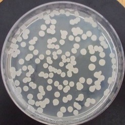 Obr. 1. Vzhled a morfologie kolonií streptomycet na zkoušených médiích – B médium