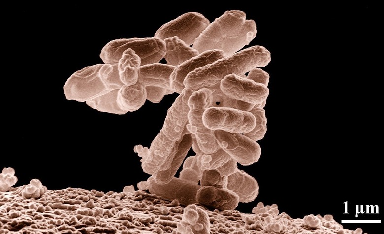Zvětšené bakterie Escherichia coli
