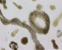 Obr. 2f Príklady organizmov v pitných a povrchových vodách – cyanobaktérie
